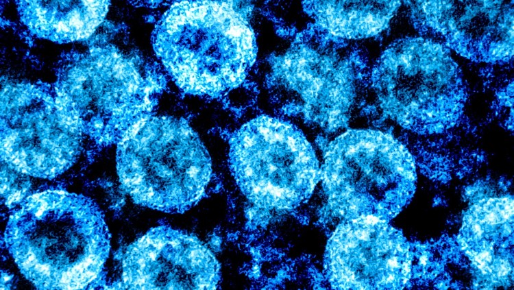 Imatge del SARS-CoV-2 obtinguda per microscopi electrònic a la Integrated Research Facility del National Institute of Allergy and Infectious Diseases, a Fort Detrick, Maryland, EEUU (2020).